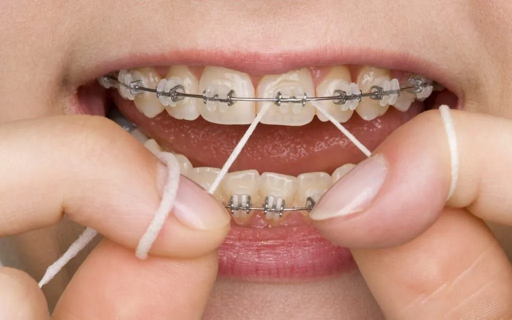 Flossing
